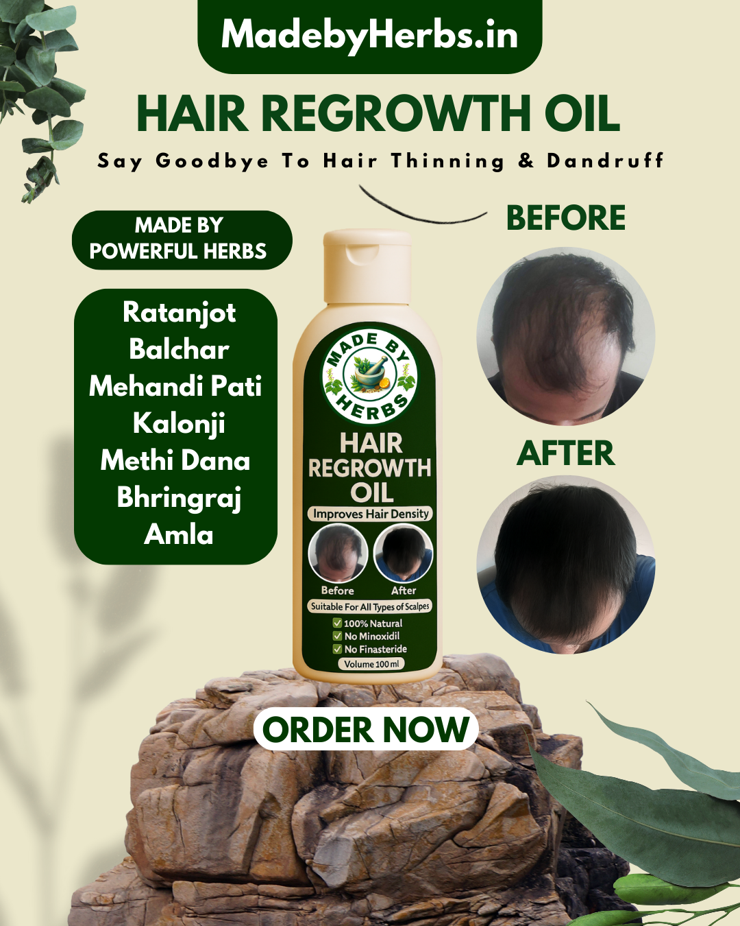 MadeByHerbs.in Hair Regrowth Oil